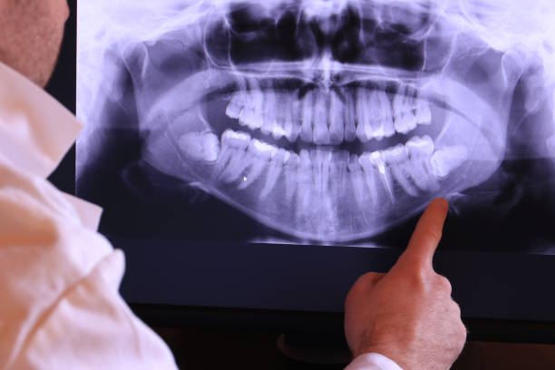 Best Emergency Tooth Extraction in Litchfield Beach, SC