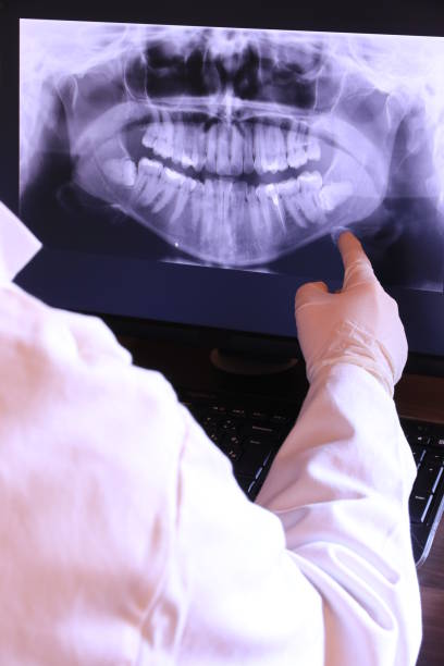 Best Emergency Tooth Extraction in Litchfield Beach, SC